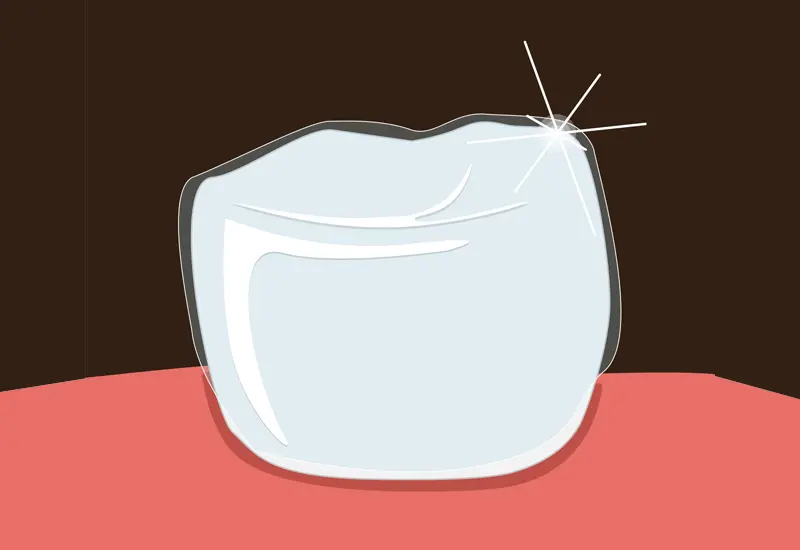 Dental Sealants Dental Sealants