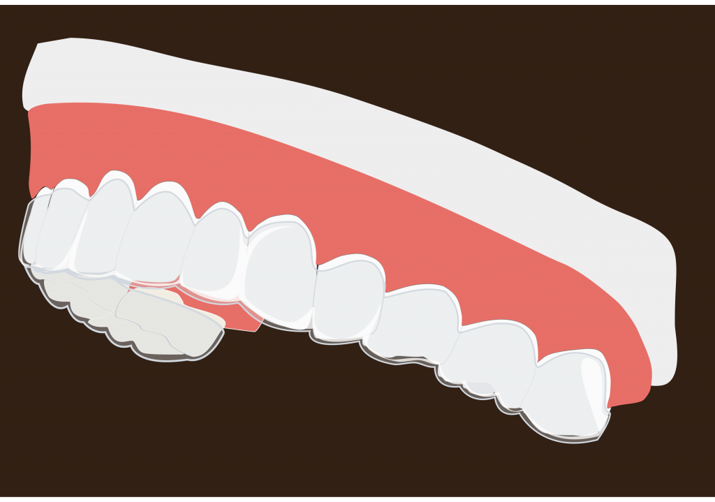 Invisalign and Retainers